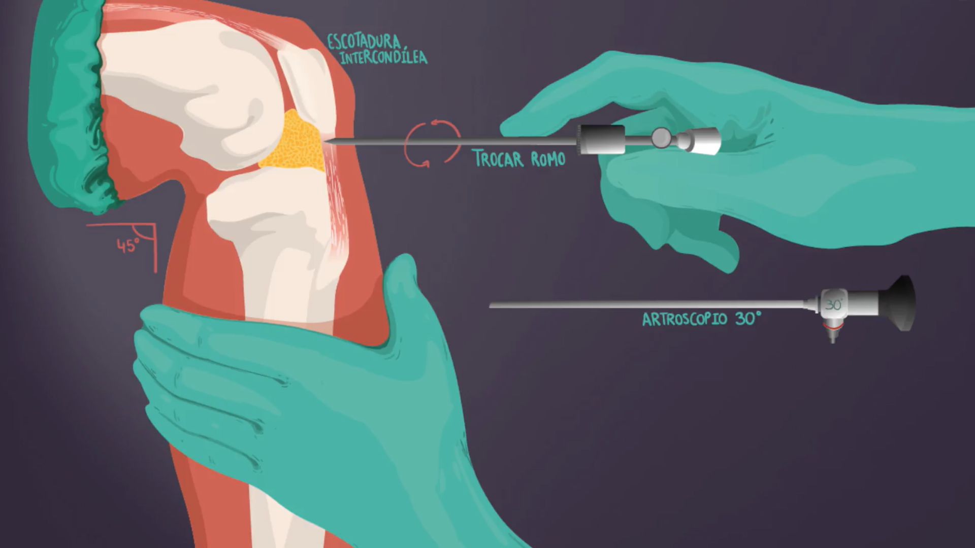 Anatomía Artroscópica De Rodilla - Doryos : Doryos